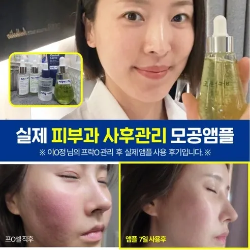 마미케어 모공 앰플 제형 사진