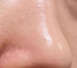 블랙헤드 제거 필오프 마스크 리뷰4